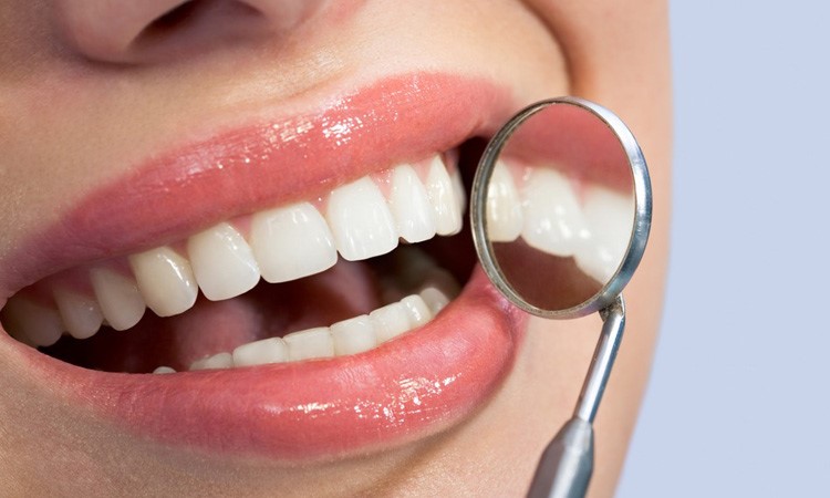 London’s Guide to Dental Implants: Transforming Smiles and Lives