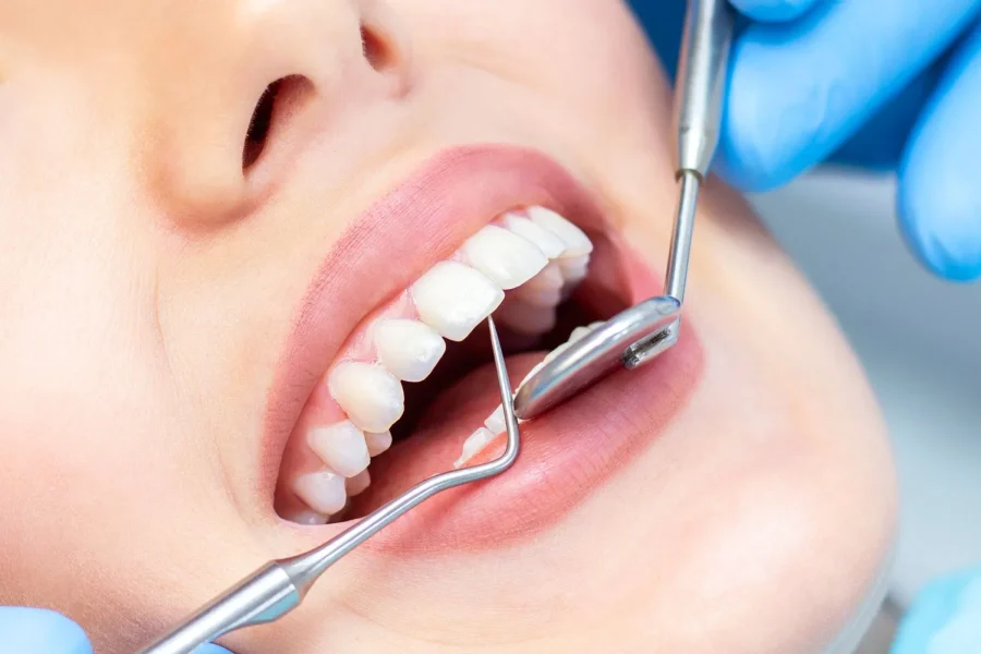 The Cultural and Historical Evolution of Beauty Standards in Dental Aesthetics Across Different Societies